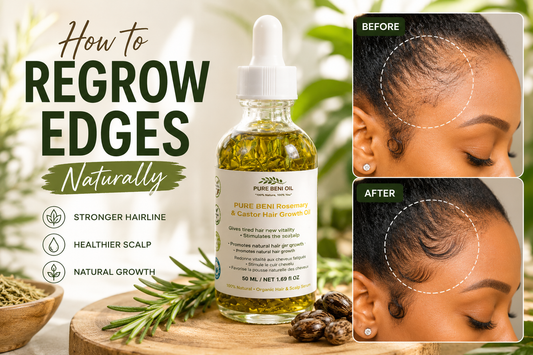 Before and after using PURE BÉNI Rosemary & Castor Hair Growth Oil – natural edge regrowth for a stronger hairline and healthier scalp