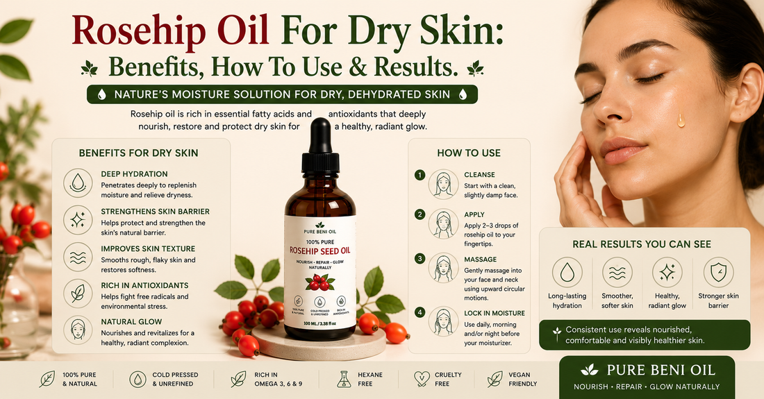 Rosehip Oil for dry skin infographic showing the benefits of Pure Beni Rosehip Oil for hydration skin barrier support soft skin and healthy glow
