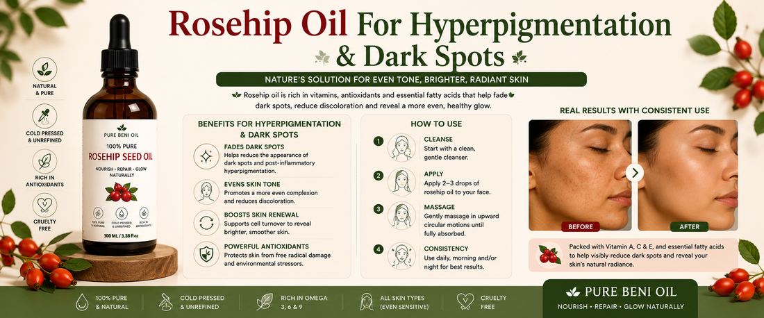 Rosehip Oil for dry skin infographic showing the benefits of Pure Beni Rosehip Oil for hydration skin barrier support soft skin and healthy glow