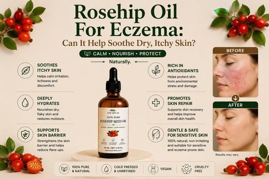 Rosehip Oil for eczema infographic featuring Pure Beni Rosehip Seed Oil, showing how it helps soothe dry itchy skin, support the skin barrier, deeply hydrate, promote skin repair and nourish sensitive skin naturally.