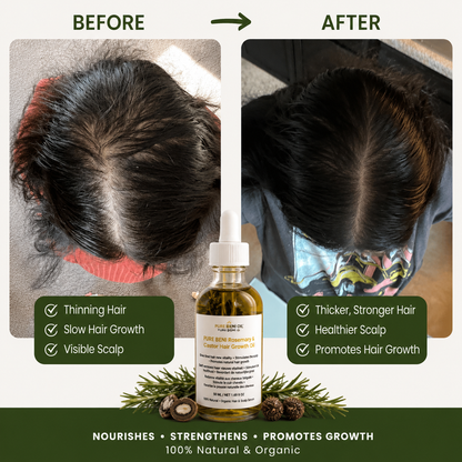 Before and after hair growth results using PURE BENI Rosemary & Castor Hair Growth Oil for thicker, healthier and fuller hair naturally.